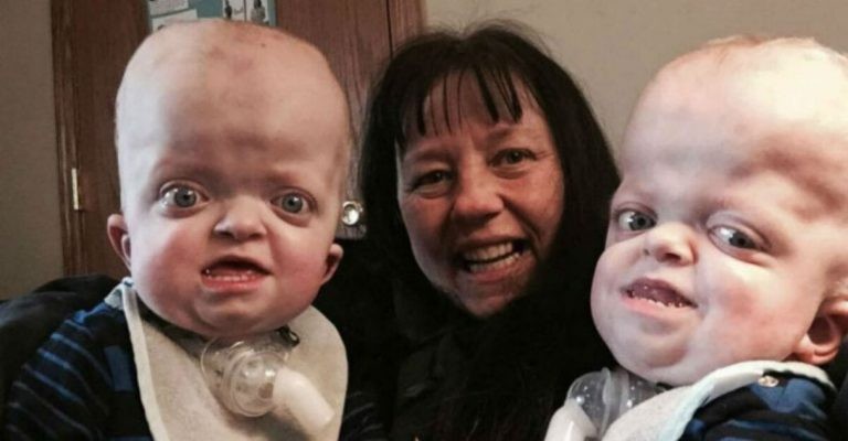 Mulher adota bebês gêmeos abandonados por causa de doença genética (Foto: Reprodução )