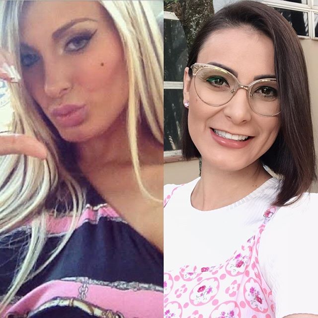 Andressa Urach mostra antes e depois (Foto: Reprodução/Instagram)