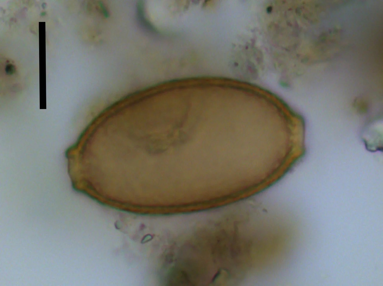 Ovo microscópico de verme descoberto em Durrington Walls no Reino Unido. A barra de escala preta mede 20 micrômetros (Foto: Evilena Anastasiou)