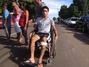 Robson Silva, de 24 anos, mora em Porto Grande e sofreu um acidente de moto (Foto: Philippe Gomes)
