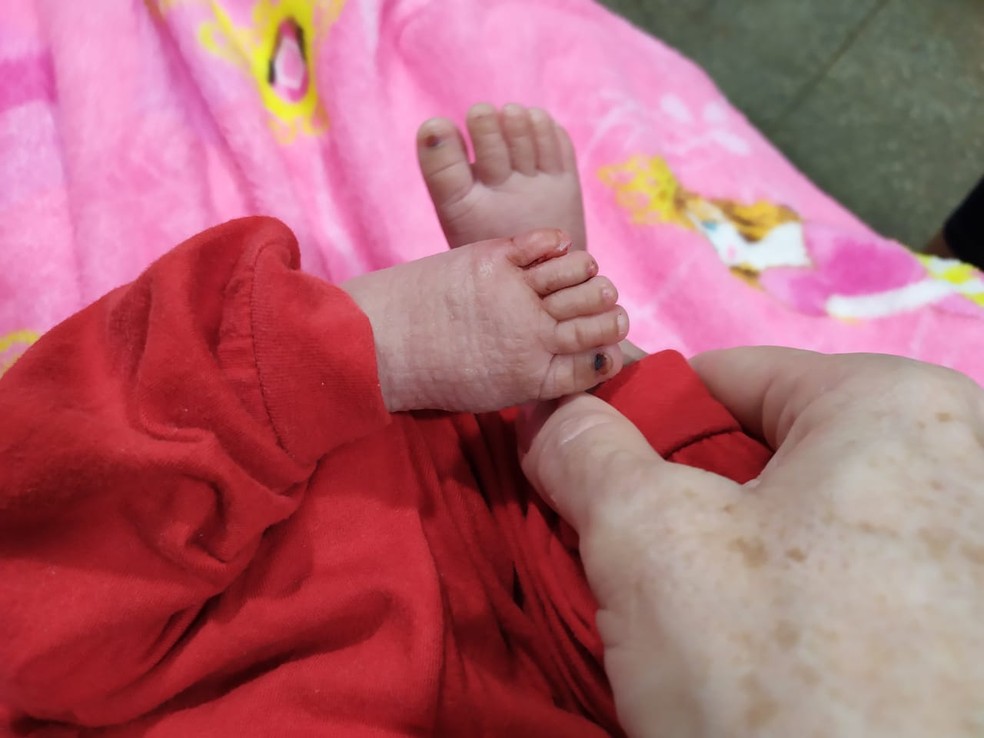 Fotos mostram maus-tratos sofrido por bebê de seis meses que foi jogado em um córrego em Tabaporã (MT) — Foto: Arquivo pessoal