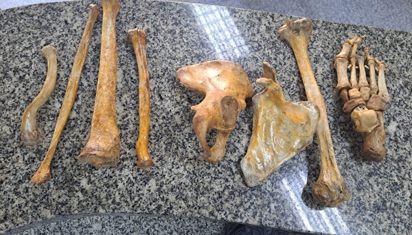 Homem é preso na Tijuca suspeito de vender ossos humanos