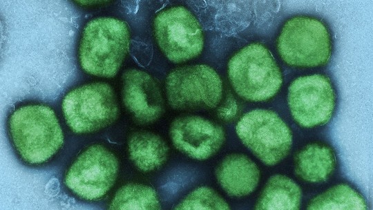 Varíola dos macacos: laboratório suíço desenvolve novo teste para detecção da doença
