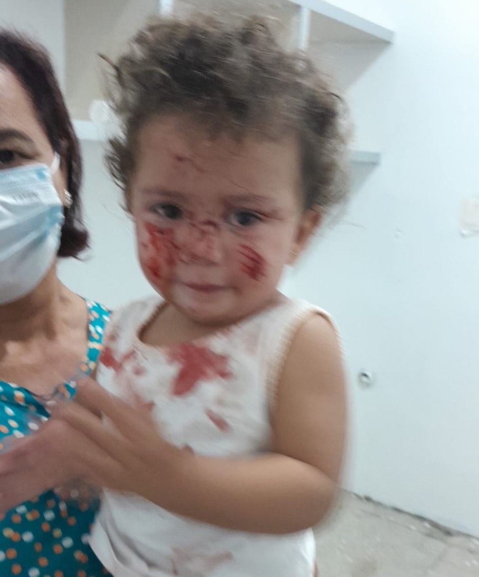 Crian&ccedil;a foi atacada por cachorro e unidade n&atilde;o tinha material esterelizado nem sutura para fazer &mdash; Foto: Cedido pela fam&iacute;lia
