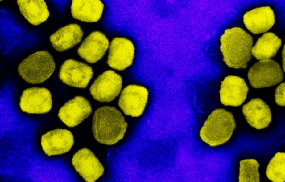 Micrografia eletrônica de transmissão colorida de partículas do vírus da varíola do macaco (amarelo) cultivadas e purificadas a partir de cultura de células. Imagem capturada no NIAID Integrated Research Facility (IRF) em Fort Detrick, Maryland, Estados Unidos.