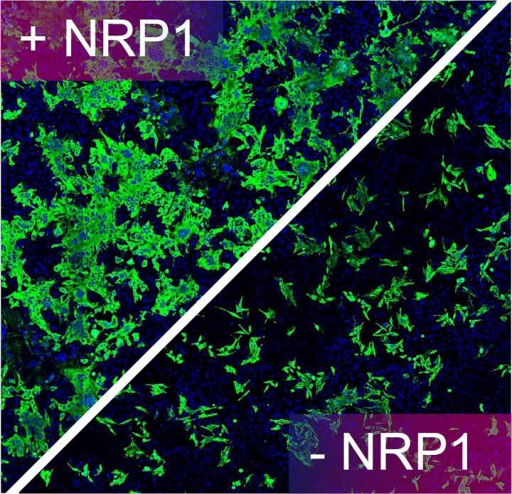 Cientistas podem ter identificado o que torna Sars-Cov-2 tão infeccioso. Acima: Células humanas infectadas pelo Sars-CoV-2 expressando proteínas virais (verde). A remoção de NRP1 das células ou o tratamento das células com uma droga ou anticorpo direcionado a NRP1 reduz a infecção por Sars-CoV-2 (metade inferior direita) (Foto: The University of Bristol)
