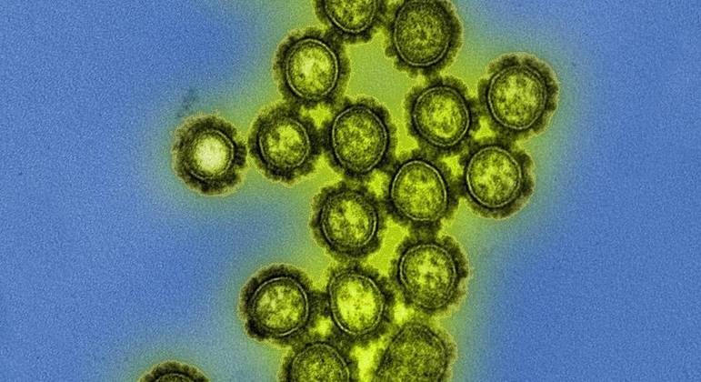 Vírus H3N2 (subtipo Darwin) gerou surtos pelo Brasil  (Foto: National Institute Of Allergy and Infectious Diseases  )