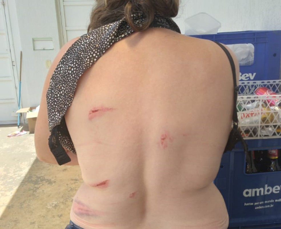 Mulher é agredida por vizinhos em São Carlos — Foto: Arquivo pessoal