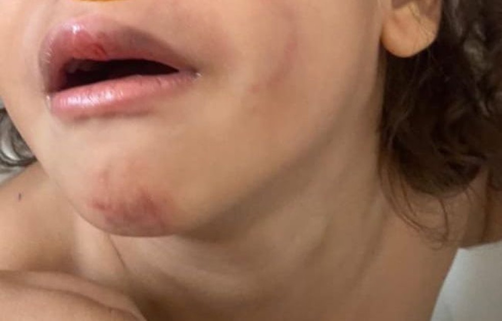 Menino de três anos tem hematomas pelo rosto. — Foto: Arquivo pessoal