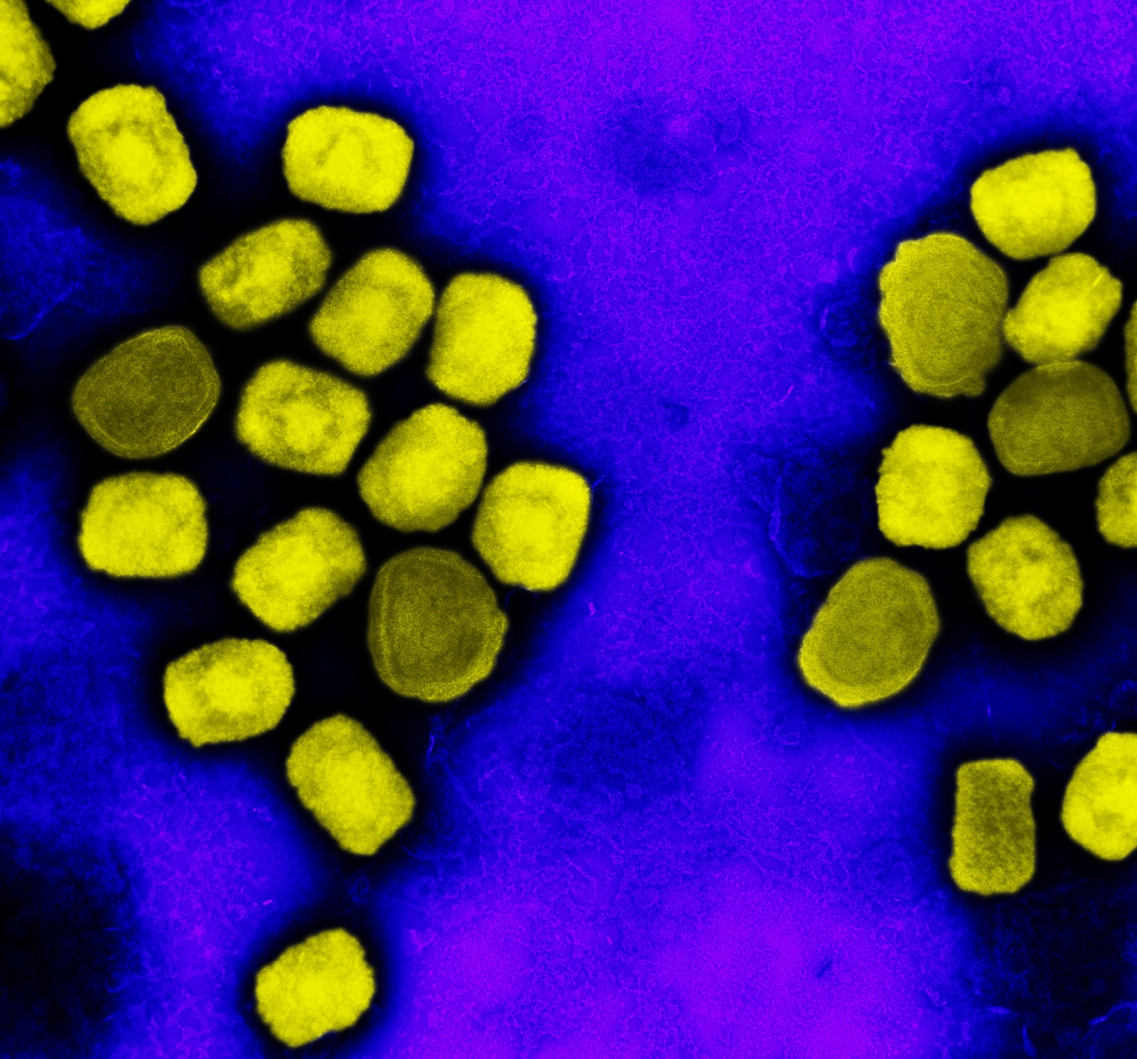 Micrografia eletrônica de partículas do vírus da varíola dos macacos (amarelo) cultivadas a partir de cultura de células (Foto: NIAID)