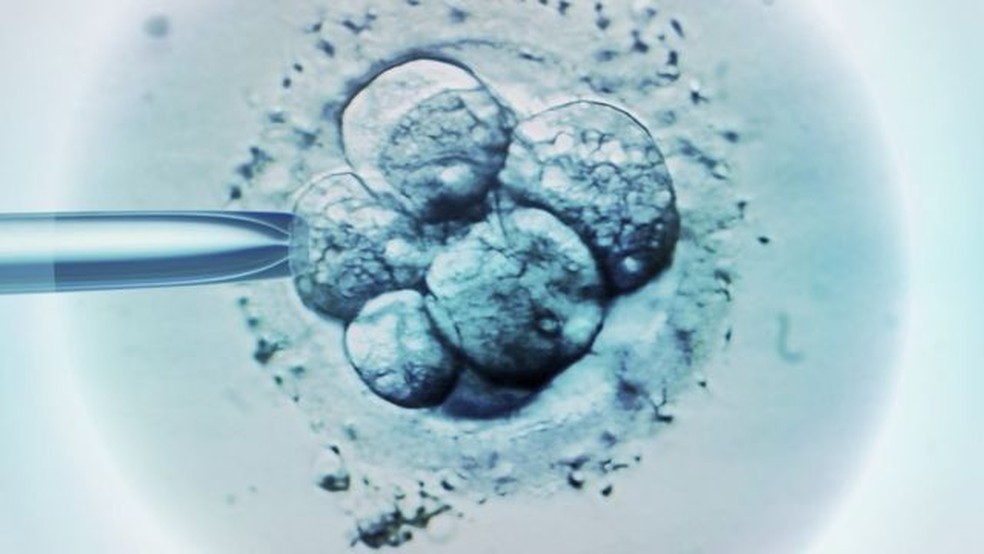 Inseminação intrauterina, fertilização in vitro: qual método é mais eficaz  e o que está disponível no SUS? | Saúde | G1