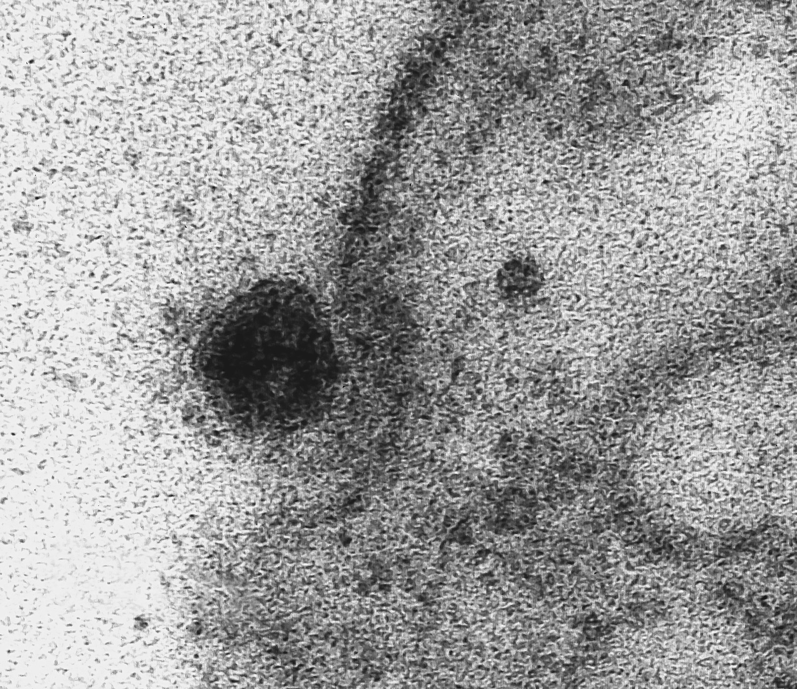 Fiocruz registra o exato momento da infecção do novo coronavírus em célula (Foto: Fiocruz)