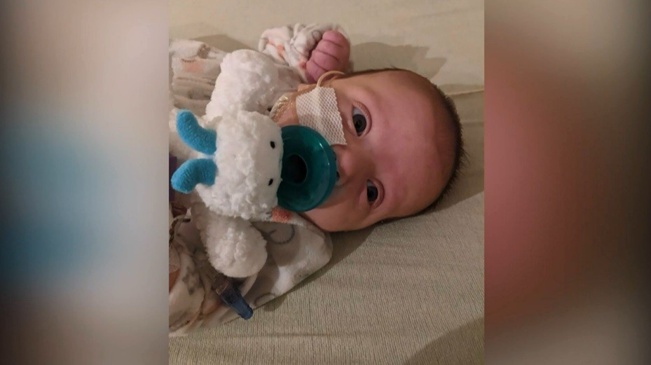 Bebê teve ataque cardíaco quando tinha apenas 7 semanas de vida (Foto: Reprodução/KMBC-TV)