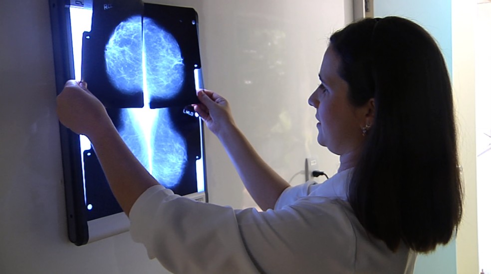 Mamografia é principal meio de prevenir câncer de mama — Foto: EPTV/Reprodução
