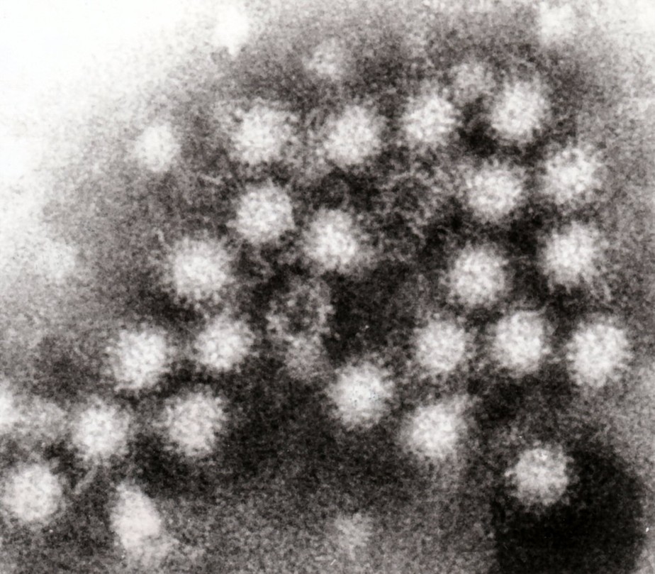 Em nota, o Ministério da Saúde informou que a notificação de casos individuais de norovírus não está contemplada na lista nacional de doenças de notificação.