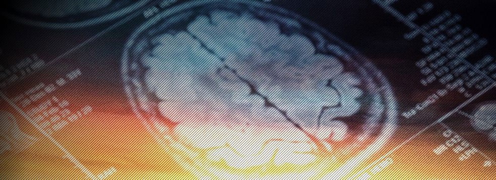 Estudos mostraram que usamos mais de 10% do cérebro mesmo em tarefas mais simples  (Foto: BBC)