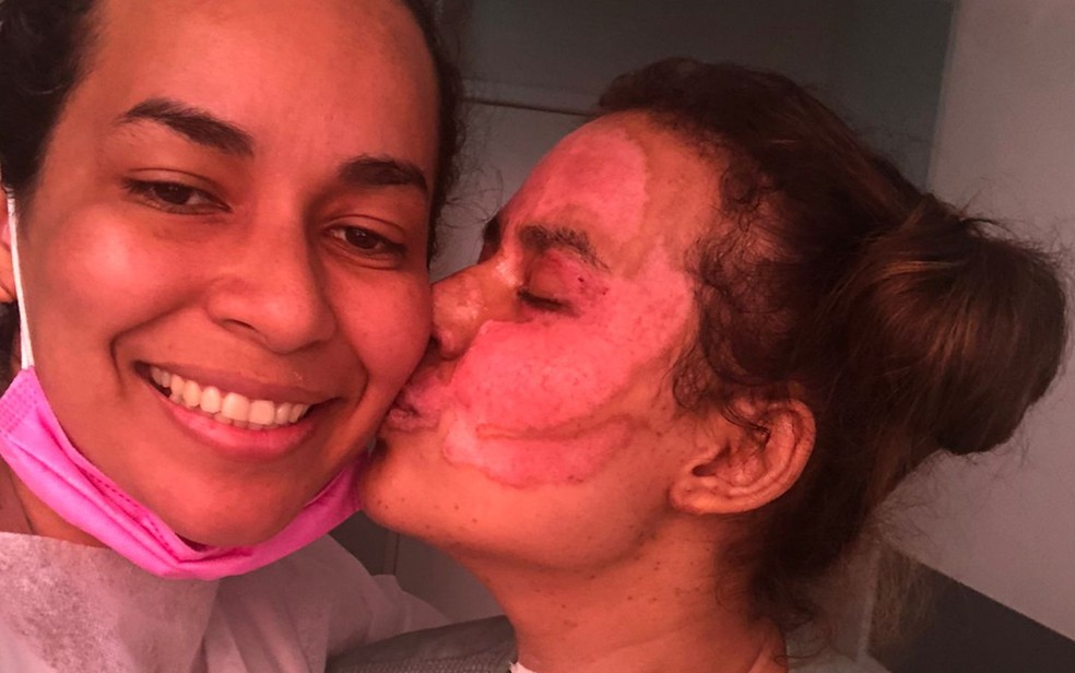 Diolange Lopes e a filha, Annelise Lopes, que teve corpo queimado durante experimento — Foto: Diolange Lopes/Arquivo Pessoal