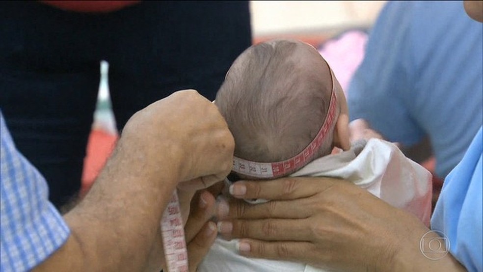 Microcefalia está associada a fatores que vão além da zika, aponta pesquisa da USP em Ribeirão Pret (Foto: Reprodução GloboNews)