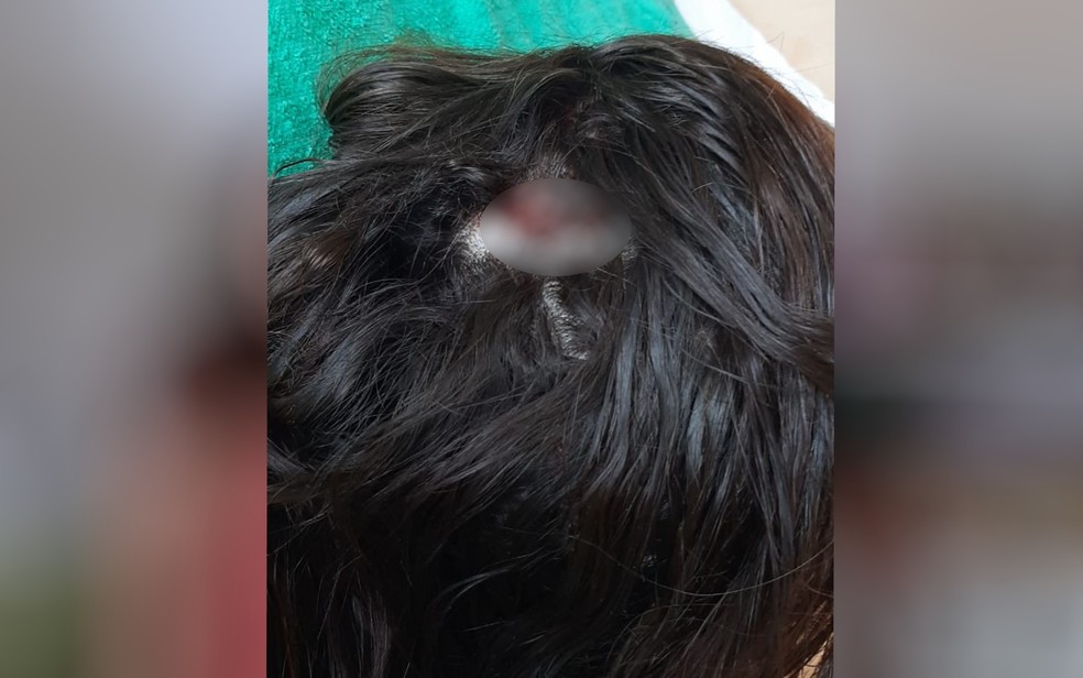 Jovem agredida com marretadas na cabeça em cidade de Goiás — Foto: Reprodução/TV Anhanguera 