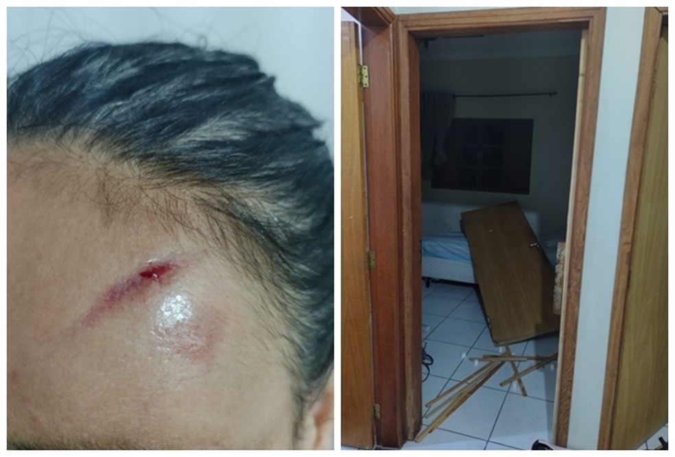 Mulher agredida teve um corte na testa em Rio Preto  — Foto: Divulgação/Guarda Civil Municipal de Rio Preto 