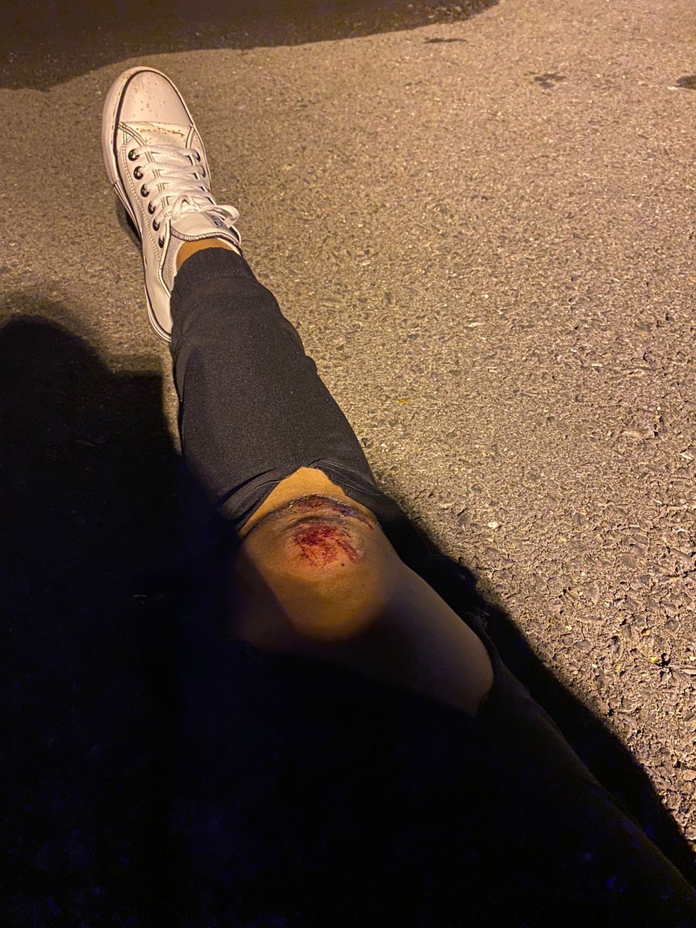 Natalya do Nascimento Campos ficou ferida. — Foto: Arquivo pessoal