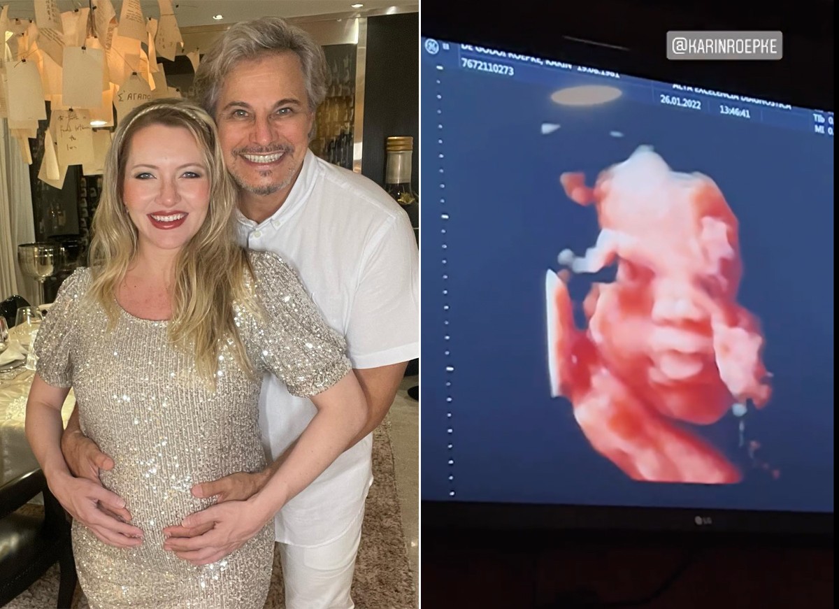 Edson Celulari mostra rostinho da filha com Karin Roepke em ultrassom (Foto: Reprodução / Instagram)