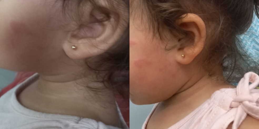 Criança de 1 ano foi agredida por professora em escola particular em Praia Grande, SP — Foto: Arquivo Pessoal