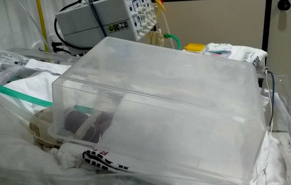 Hospital de Santana improvisa incubadora com recipiente de plÃ¡stico em UTI neonatal para atender bebÃª â€” Foto: CRM-AP/DivulgaÃ§Ã£o