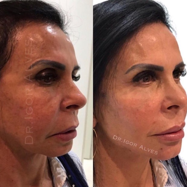 Gretchen (Foto: Instagram/Reprodução)