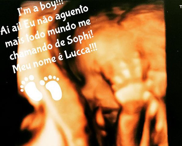 Ultrassom de Lucca, filho da atriz Fernanda Machado (Foto: Arquivo pessoal)