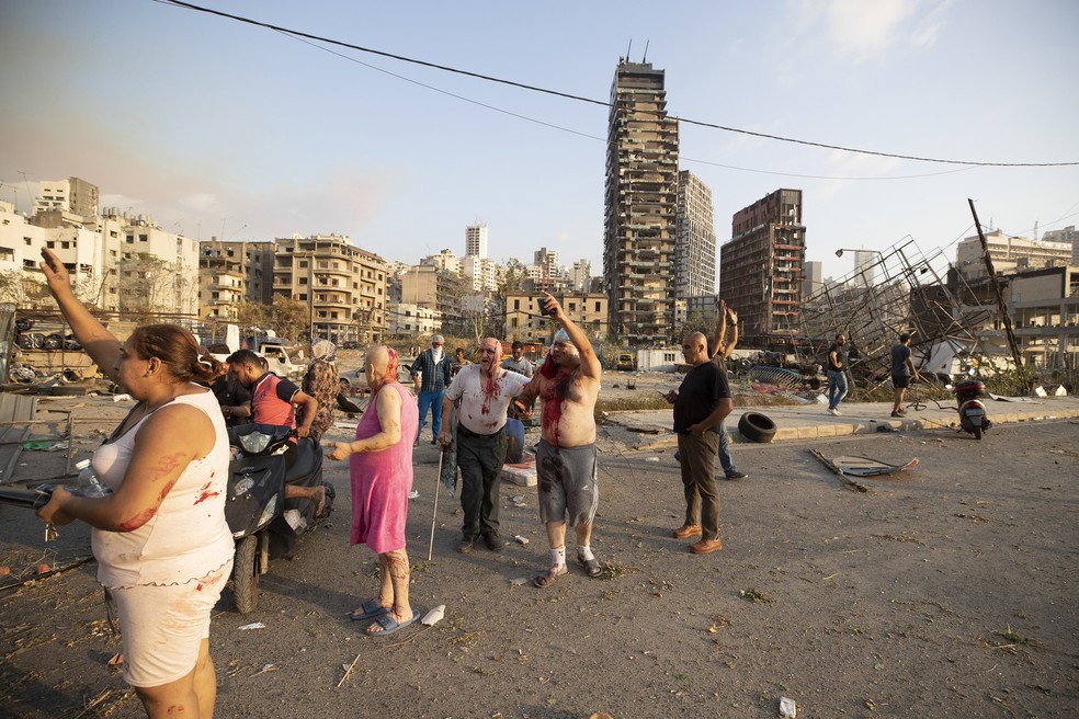 Pessoas feridas depois de explosão em Beirute, Líbano — Foto: Hassan Ammar/AP