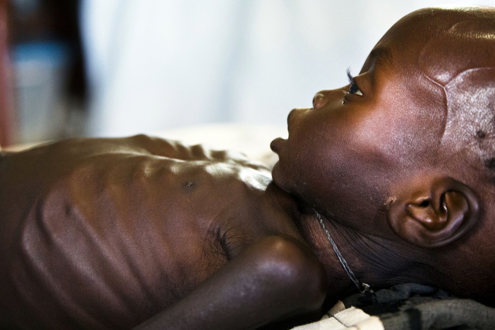 Governo Do Sudão Do Sul Alerta Que Quase Metade De Sua População Está Sujeita à Fome Mundo G1 