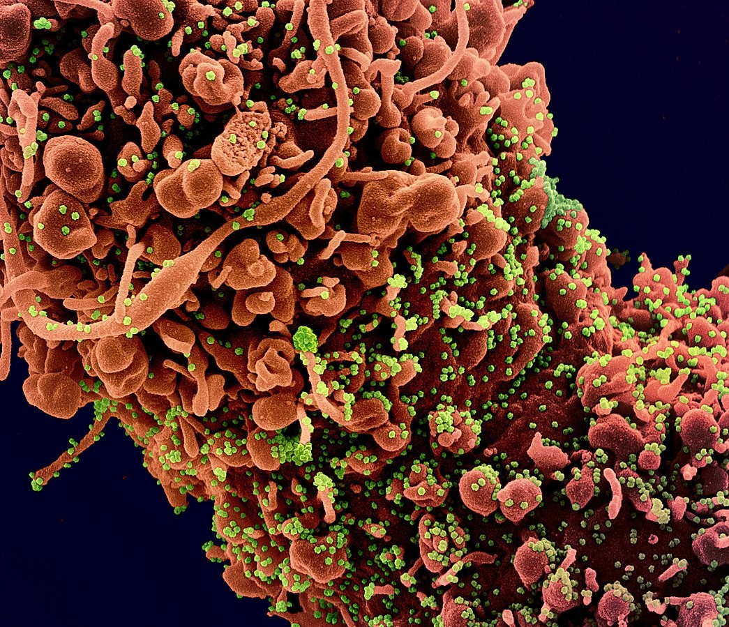 Micrografia eletrônica de uma célula infectada com partículas do vírus Sars-CoV-2 (em verde)  (Foto: Wikimedia Commons )