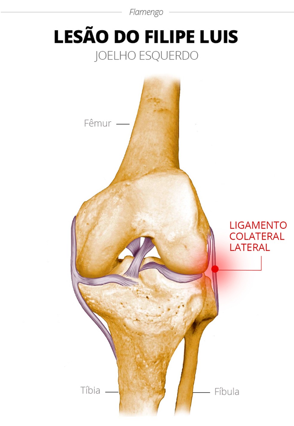 Info Lesao Filipe luis Joelho Esquerdo Ligamento Medial &mdash; Foto: infoesporte