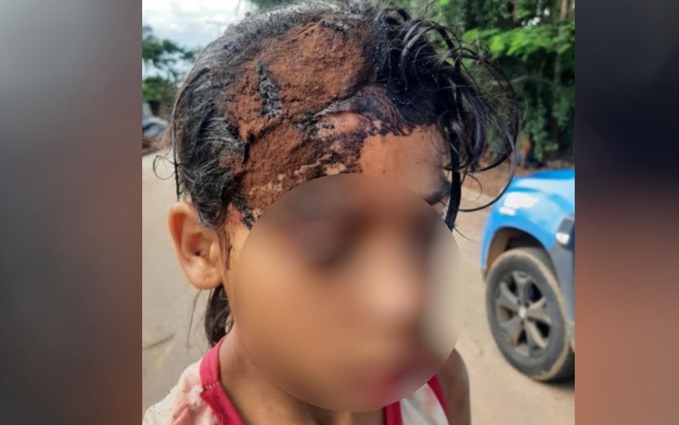 Menina de 9 anos leva pedrada na cabeça após briga por chocolate — Foto: Reprodução/TV Anhanguera