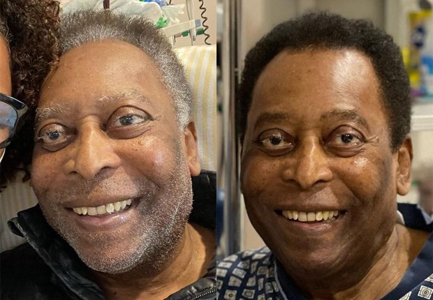 Antes e depois de Pelé pintar os cabelos (Foto: Reprodução/Instagram)