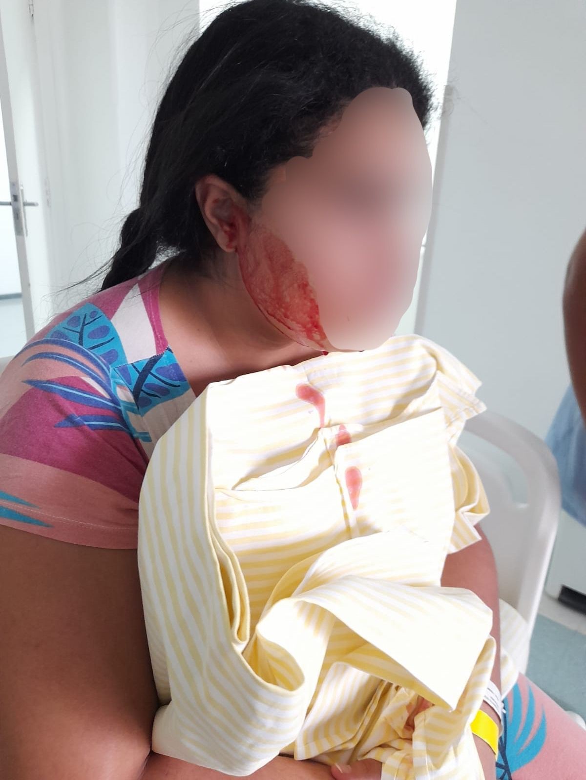 Jovem que começa a sangrar 'do nada' é internada em SP após começar a desmaiar: 'minha filha piora a cada dia'