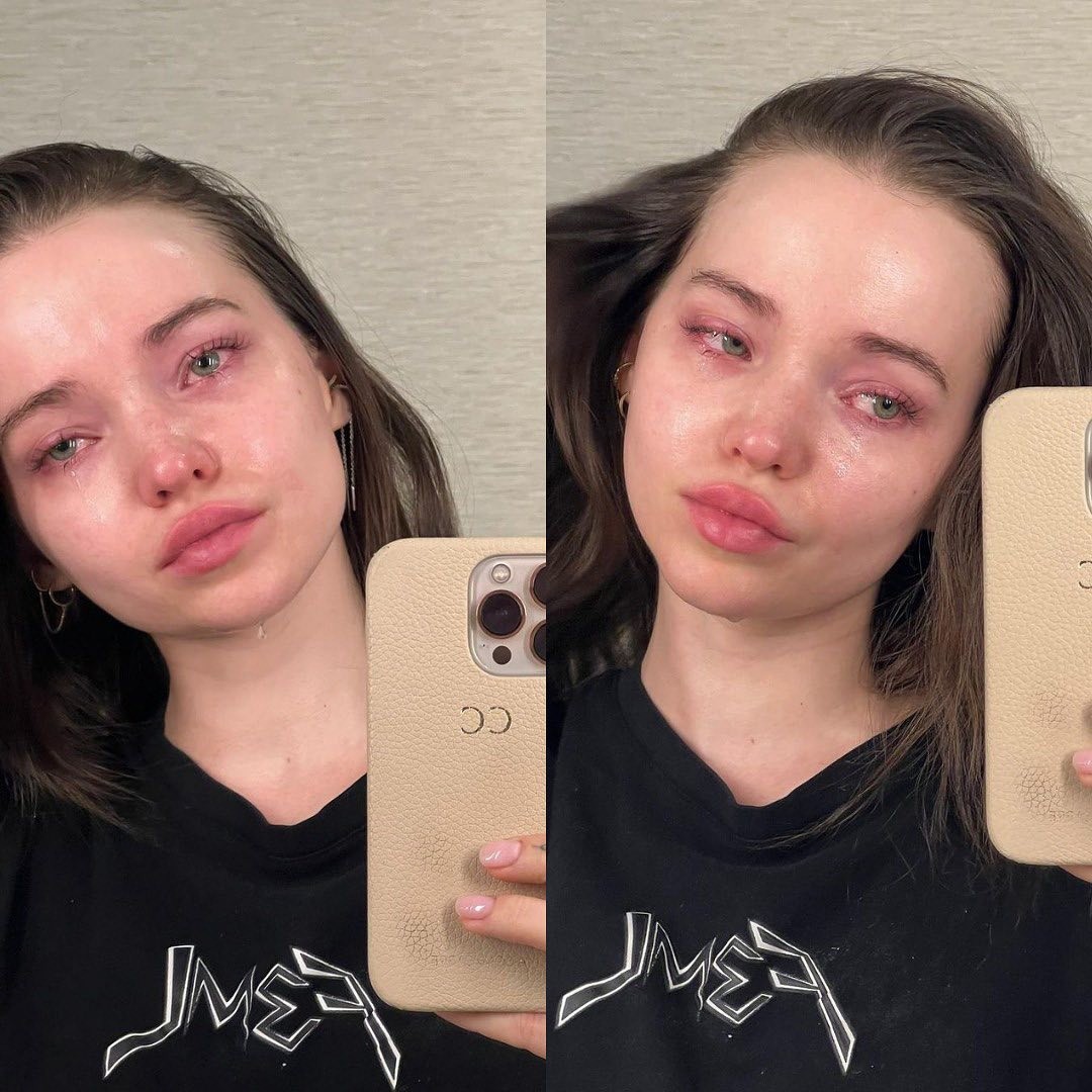 Dove Cameron posta série de fotos sobre sua luta contra depressão e dismorfia (Foto: Reprodução Instagram)