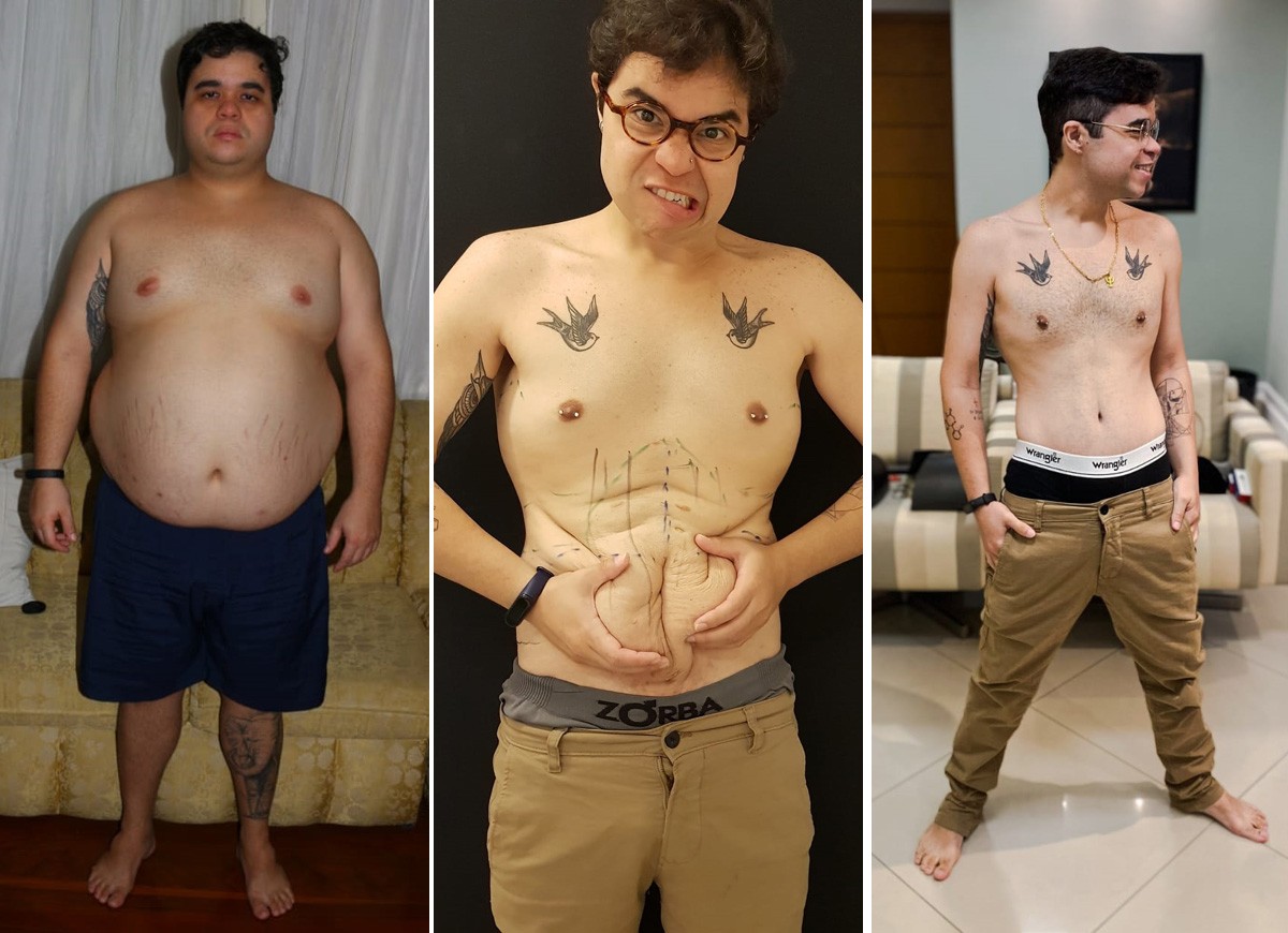 Jorginho Doda antes, depois de eliminar mais de 60 quilos com a bariátrica e atualmente, após as cirurgias reparadoras (Foto: Arquivo pessoal)