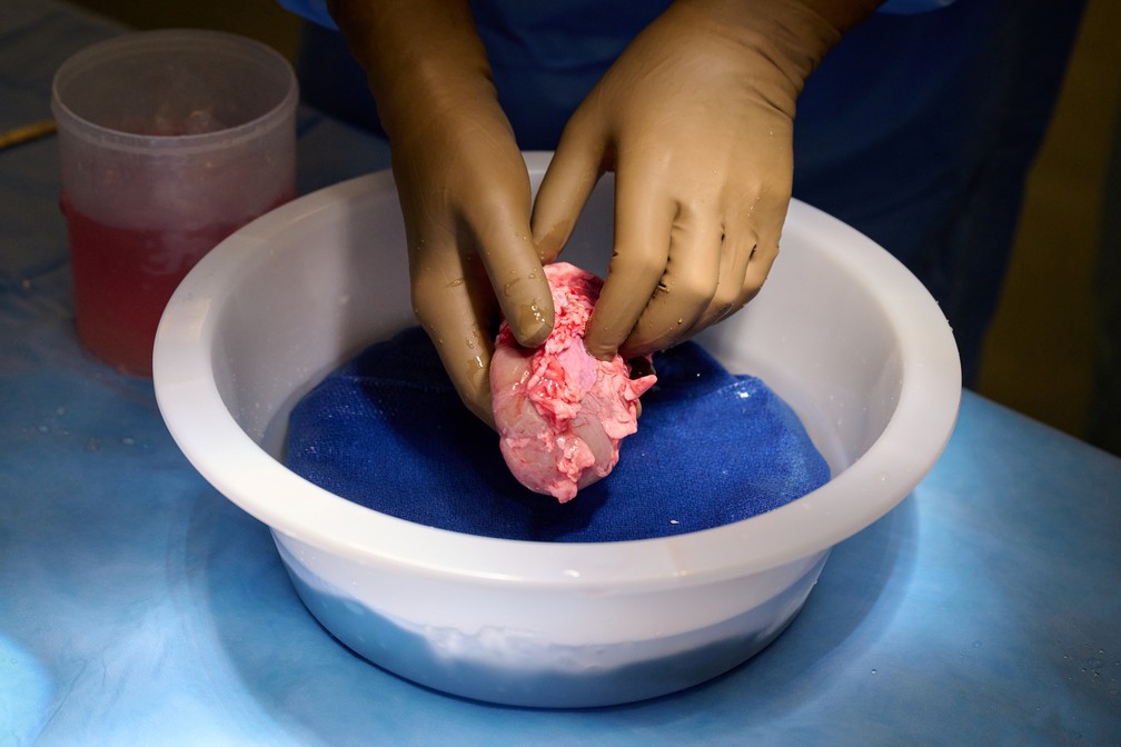 Na foto, sem data, um rim de porco geneticamente modificado é limpo e preparado para transplante em um humano na NYU Langone Health em Nova York, nos Estados Unidos. — Foto: Joe Carrotta para NYU Langone Health/via Reuters
