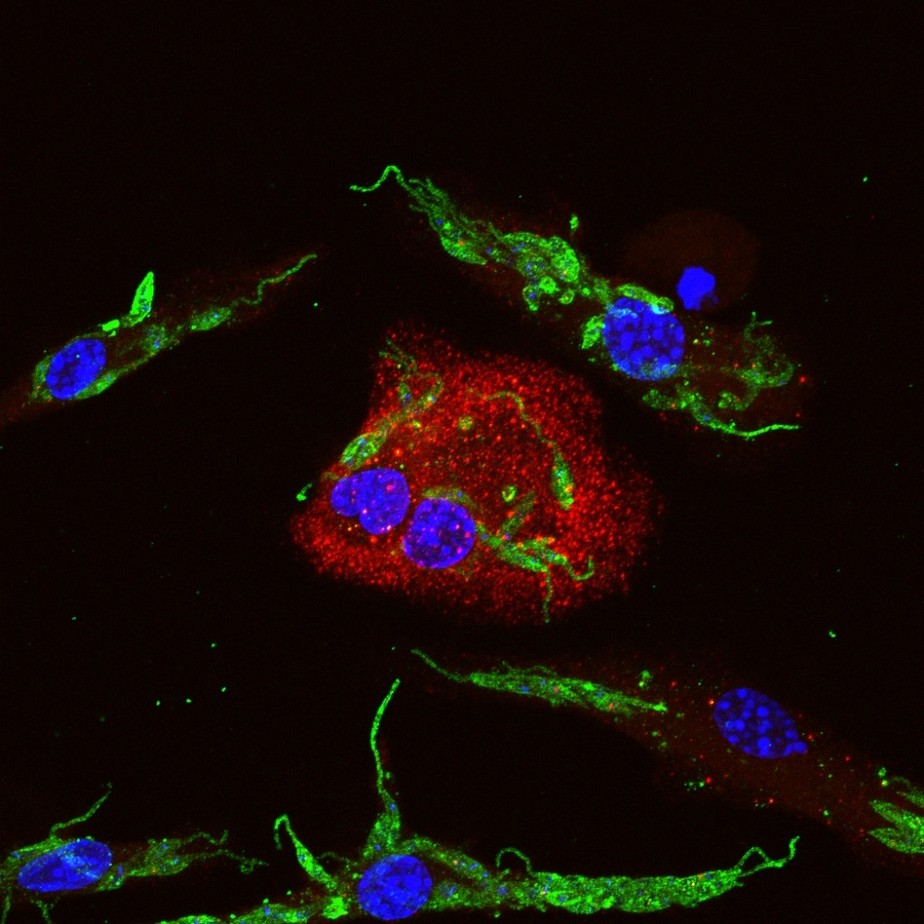 Técnica de imunofluorescência mostra macrófagos (em azul) infectados com Leishmania amazonensis (em verde). Em vermelho, a proteína gasdermina-D expressa pelo macrófago