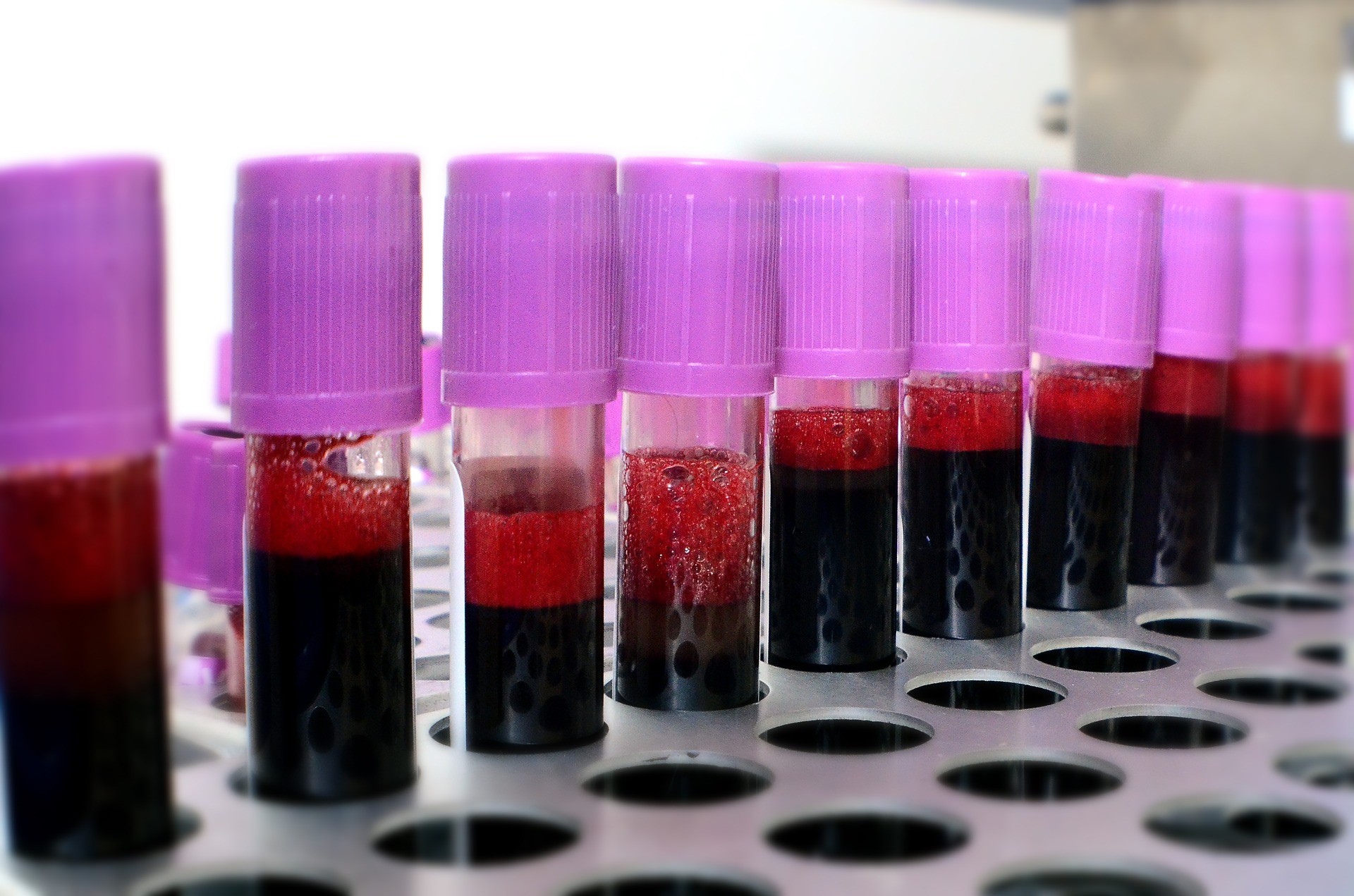 Mulheres têm mais restrições para doar plaquetas sanguíneas (Foto: Belama/Pixabay)
