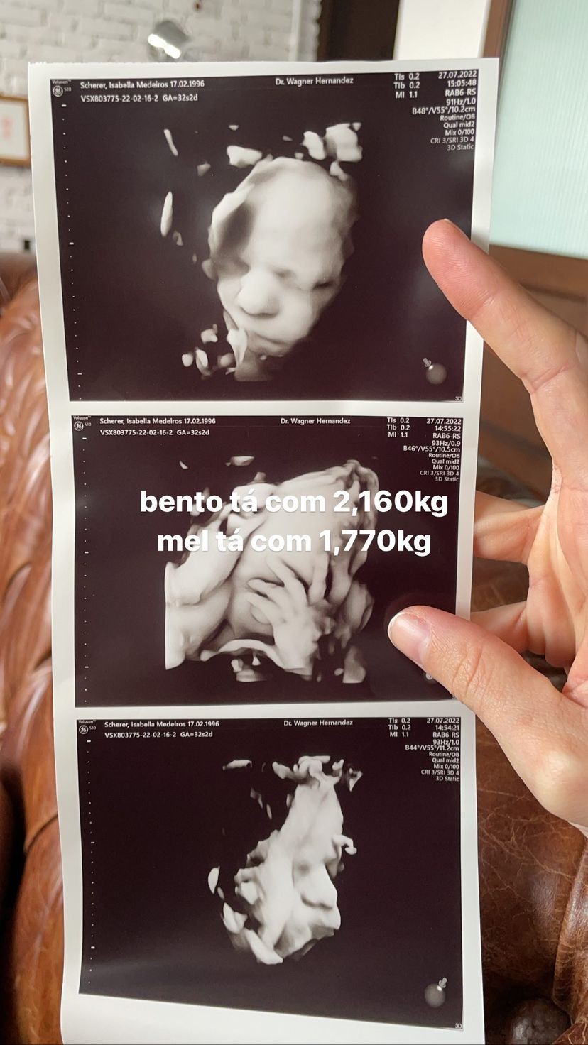 Isa Scherer mostrou ultrassom de Bento e Mel (Foto: Reprodução/Instagram)
