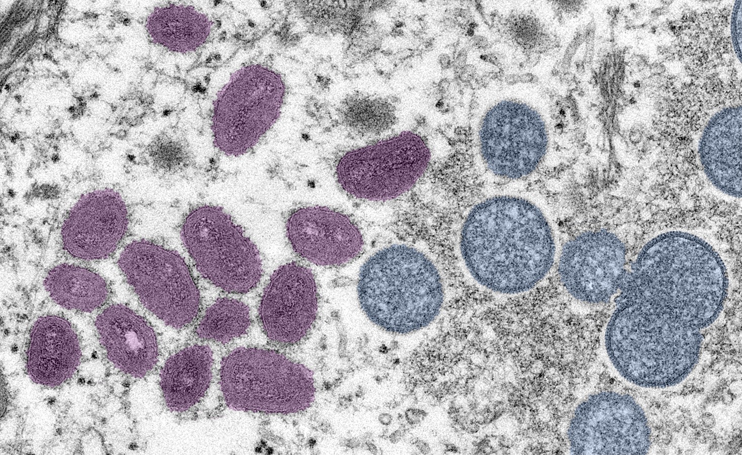 Vírus da varíola dos macacos pode ser detectado em sêmen, saliva e outras secreções (Foto: Cynthia S. Goldsmith/ CDC)
