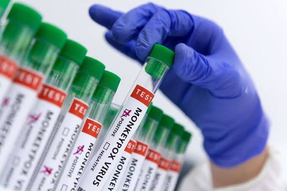 Amostras para testes de varíola dos macacos — Foto: Agência Brasil/Diulgação