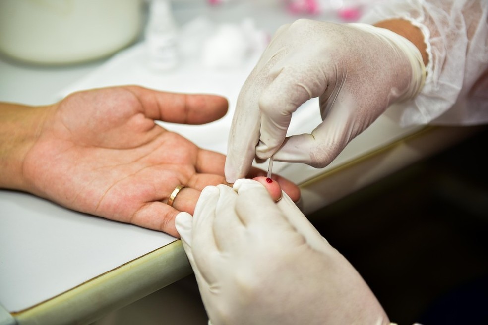Teste rápido para detecção do vírus HIV — Foto: Secom/Divulgação