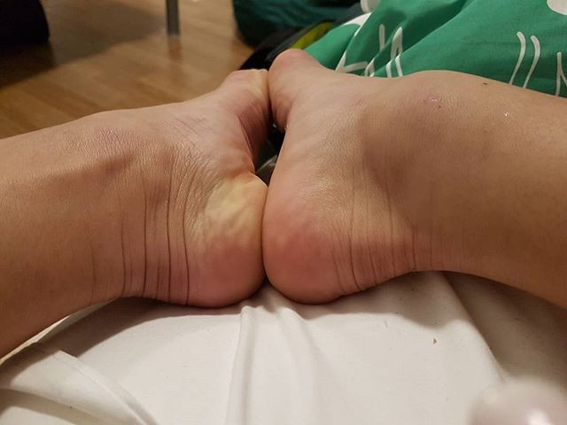 Jade Barbosa mostra tornozelo  (Foto: Reprodução / Instagram)
