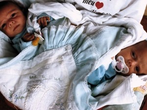 Larissa e Lorrayne Gonçalves foram separadas em julho de 2010 no Hospital Materno Infantil, em Goiânia (Foto: Cristina Cabral/ O Popular)