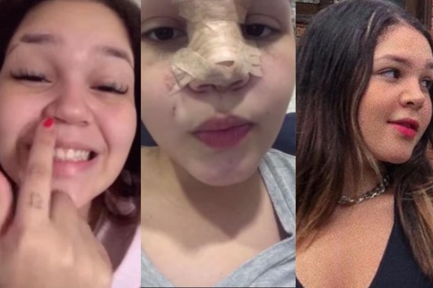Aysha Benelli também fez plástica no nariz (Foto: Reprodução/ Instagram)