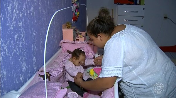 Familia Faz Campanha Para Conseguir Cirurgia De Bebe Que Nasceu Com Cerebro Fora Do Cranio Sorocaba E Jundiai G1
